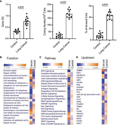 SFPQ Promotes Lung Cancer Malignancy via Regulation of CD44 v6 Expression